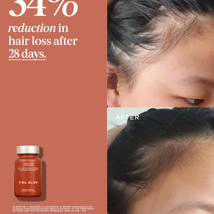 Vida Glow - Hairology Capsules