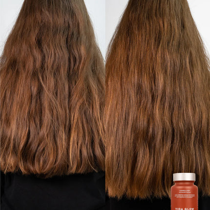 Vida Glow - Hairology Capsules